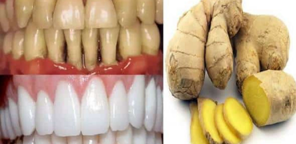 Make this Remedy with Ginger and Salt to Whiten Teeth - Light Recipes